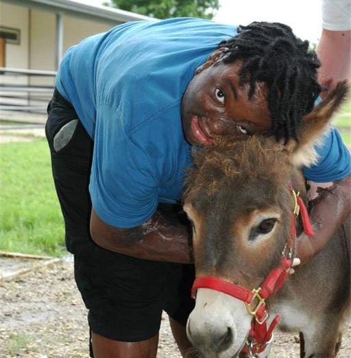 Young boy bending over and hugging a donkey
